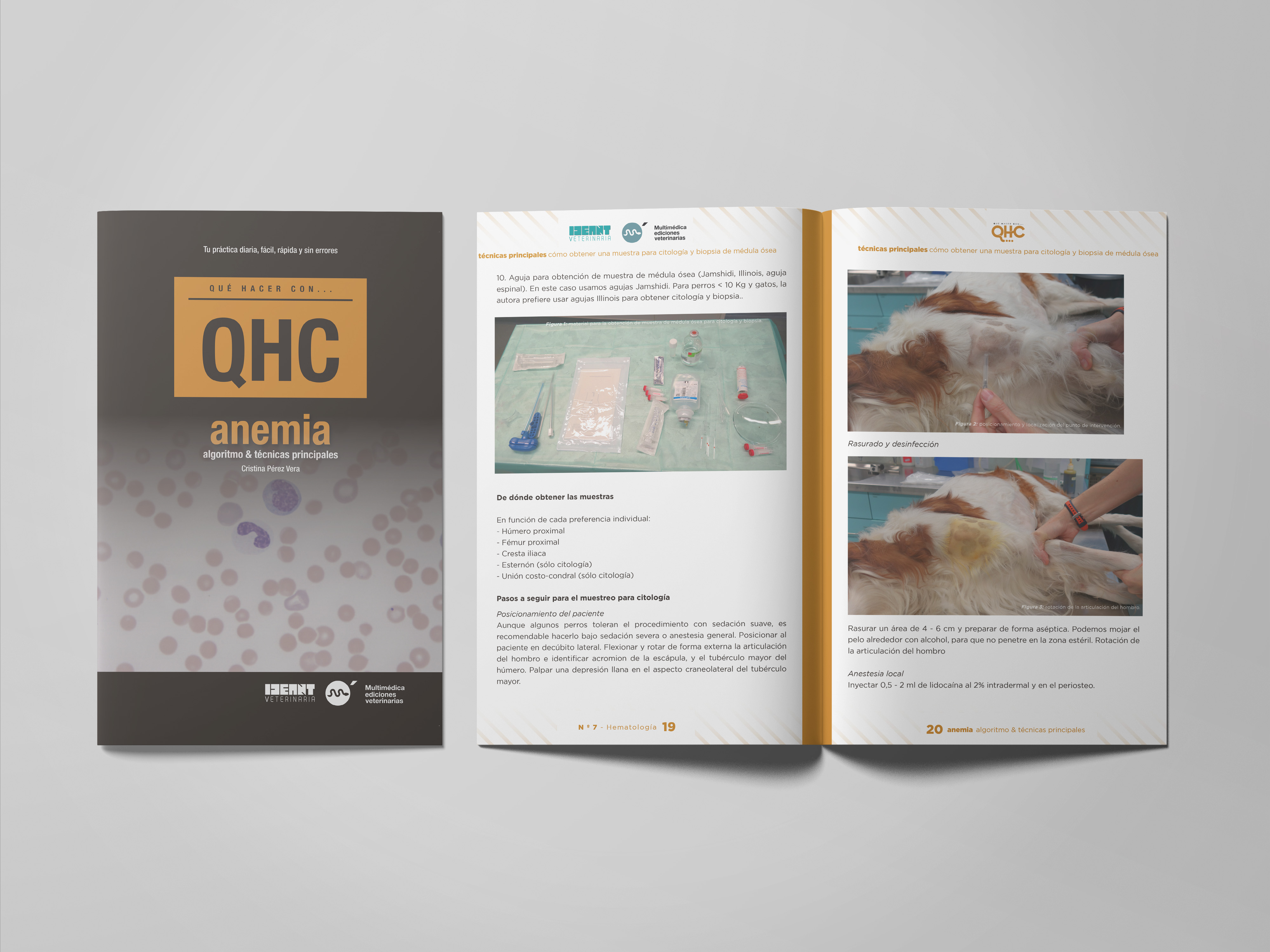 Revista QHC Anemia, algoritmo & técnicas principales