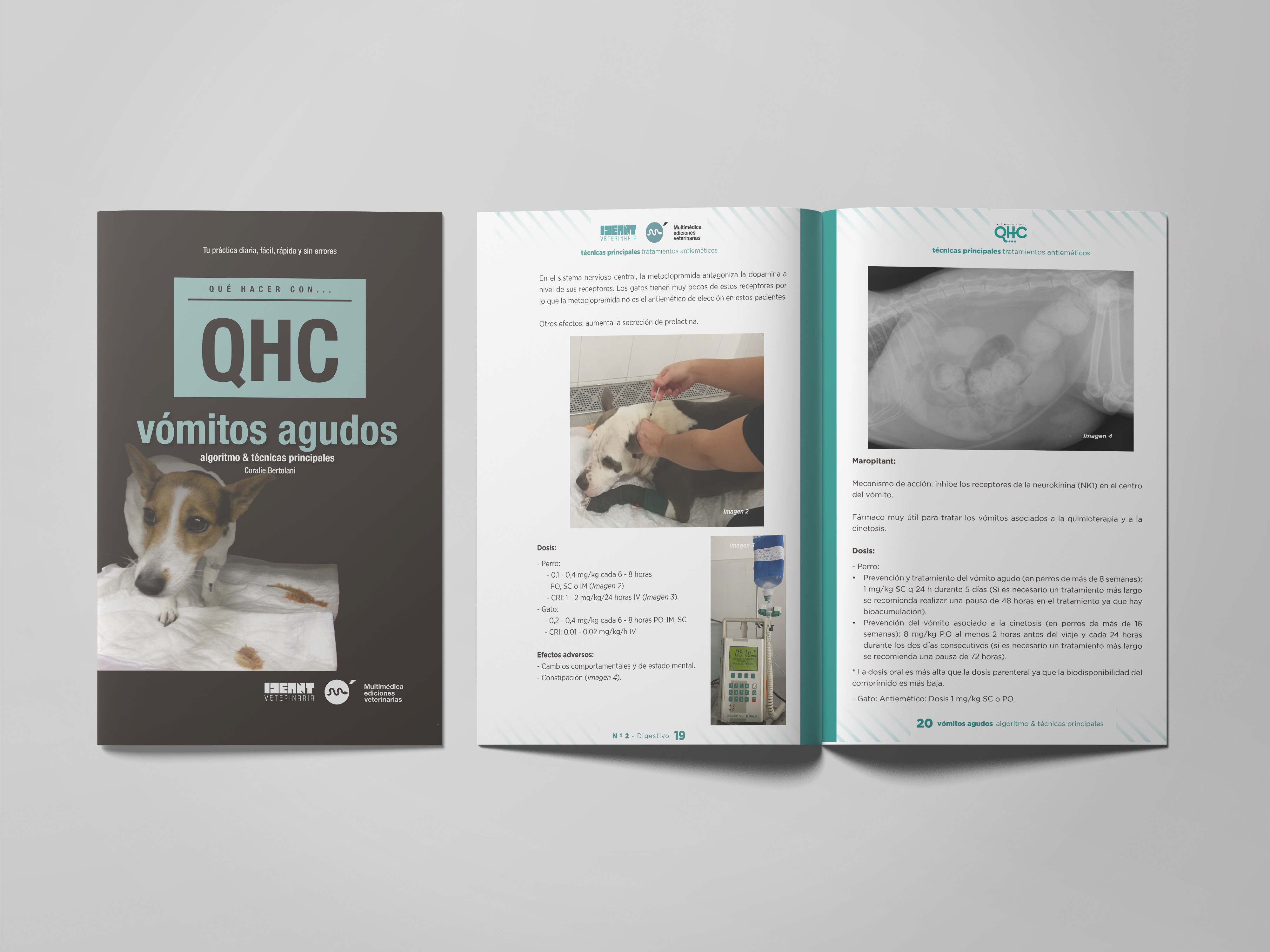 Revista QHC Vómitos Agudos, algoritmo & técnicas principales
