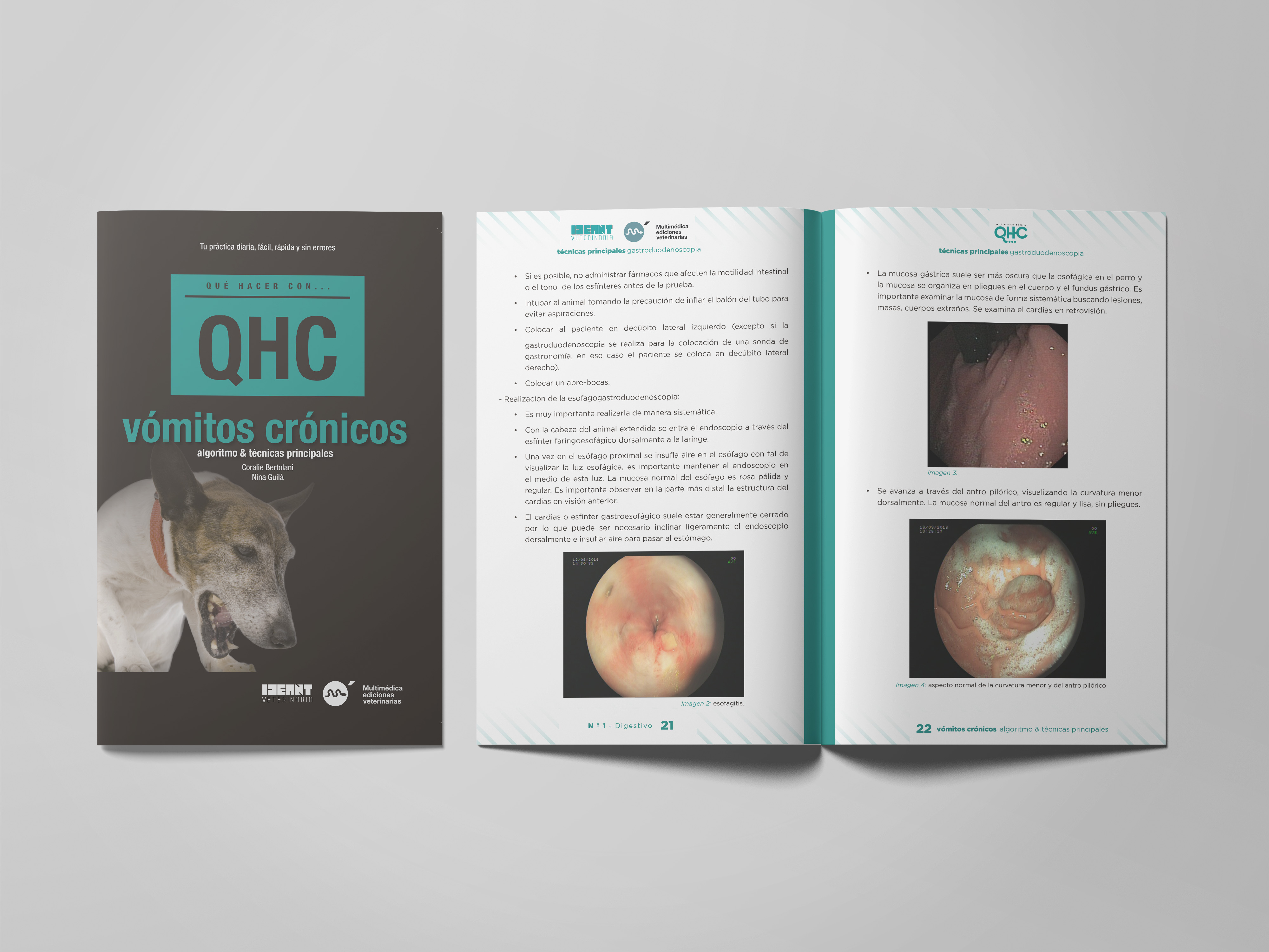 Revista QHC Vómitos Crónicos, algoritmo & técnicas principales