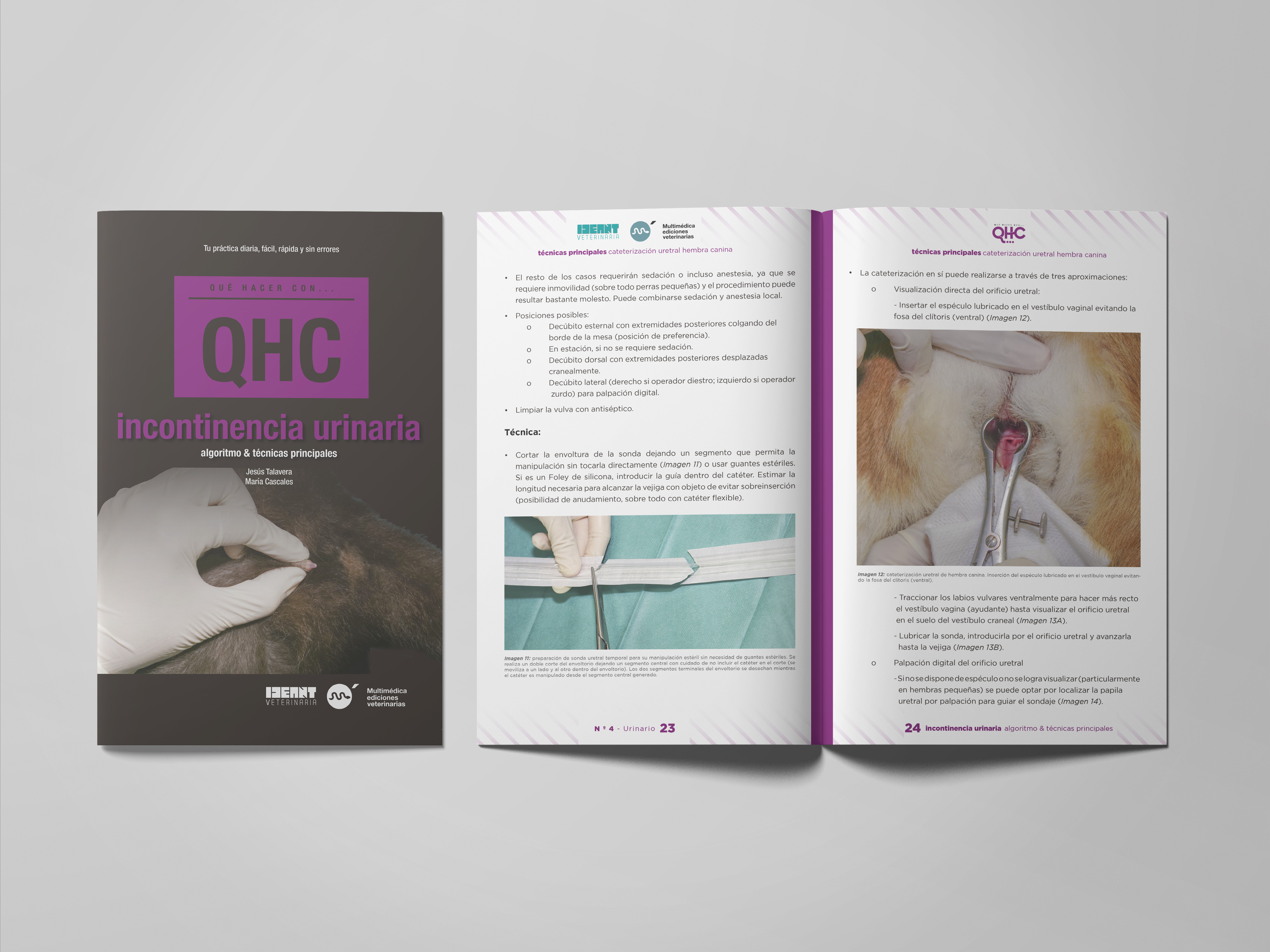 Revista QHC Incontinencia urinaria