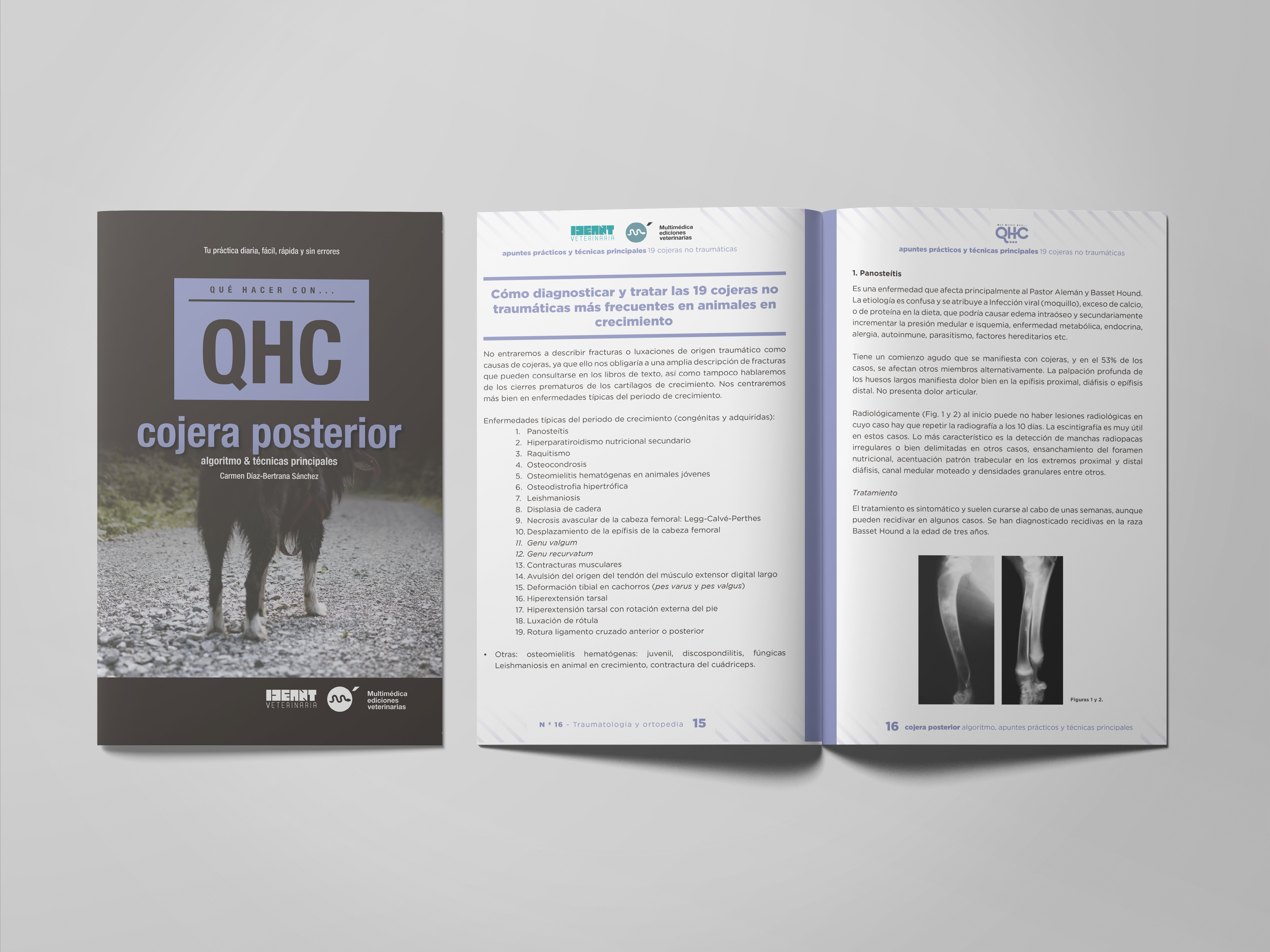 Revista QHC Cojera Posterior, algoritmo & técnicas principales